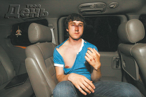 500x333, 43 Kb / журналист, побитый