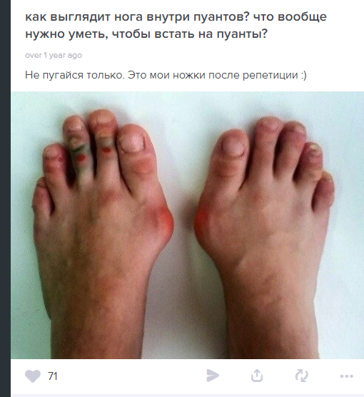 510x556, 289 Kb / балерина, пуанты, уродство, ноги 510x556, 289 Kb / балерина, пуанты, уродство, ноги