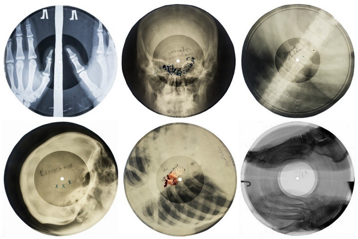 1199x800, 160 Kb / Рентген, пластинки