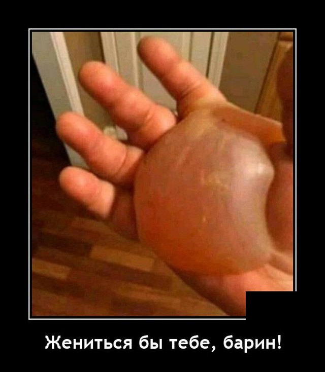 640x734, 57 Kb / Рука, ожог, барин, жениться