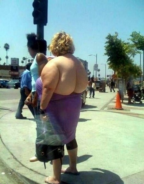 473x604, 75 Kb / жопа, спина, жир