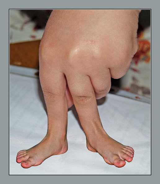 516x592, 26 Kb / кисть, пальцы, ноги, бред