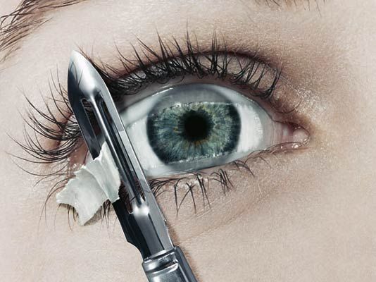 534x400, 40 Kb / глаз, пленка