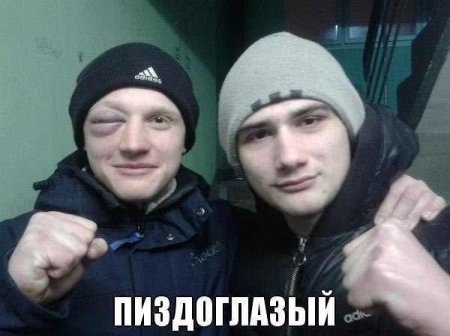 450x336, 29 Kb / глаз, фингал, гопники