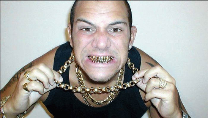 700x398, 48 Kb / золото, цепочки, зубы, долбоёб