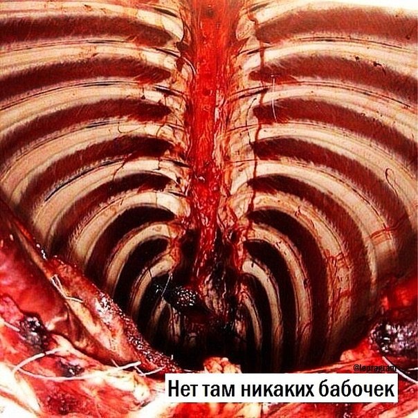 604x604, 120 Kb / позвоночник, рёбра, живот