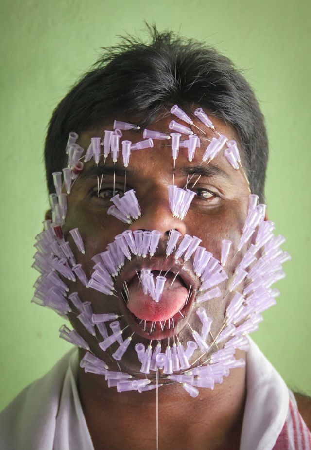 640x925, 77 Kb / Игла, восставший из ада, акупунктура