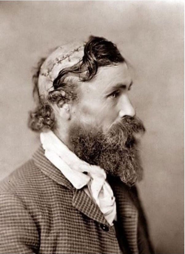 602x824, 69 Kb / скальп, макГи