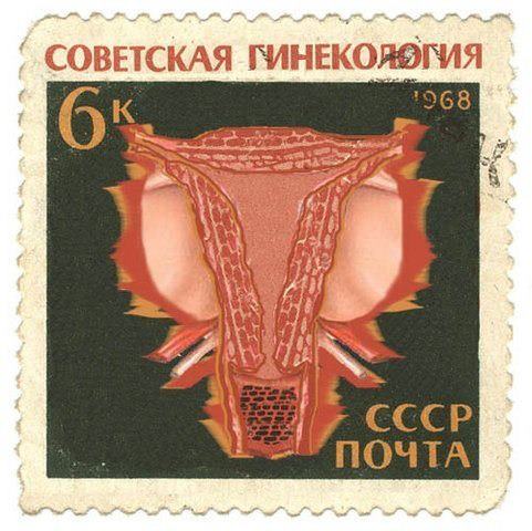481x480, 51 Kb / марка, матка, советская, геникология