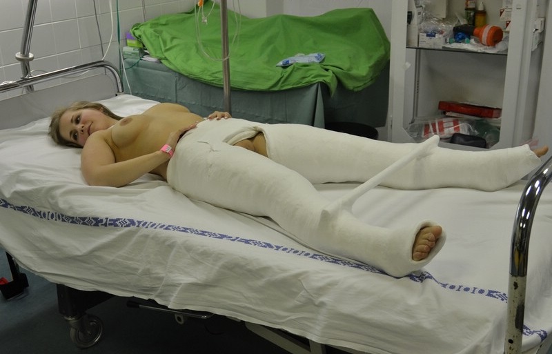 800x513, 97 Kb / койка, гипс, перекладина